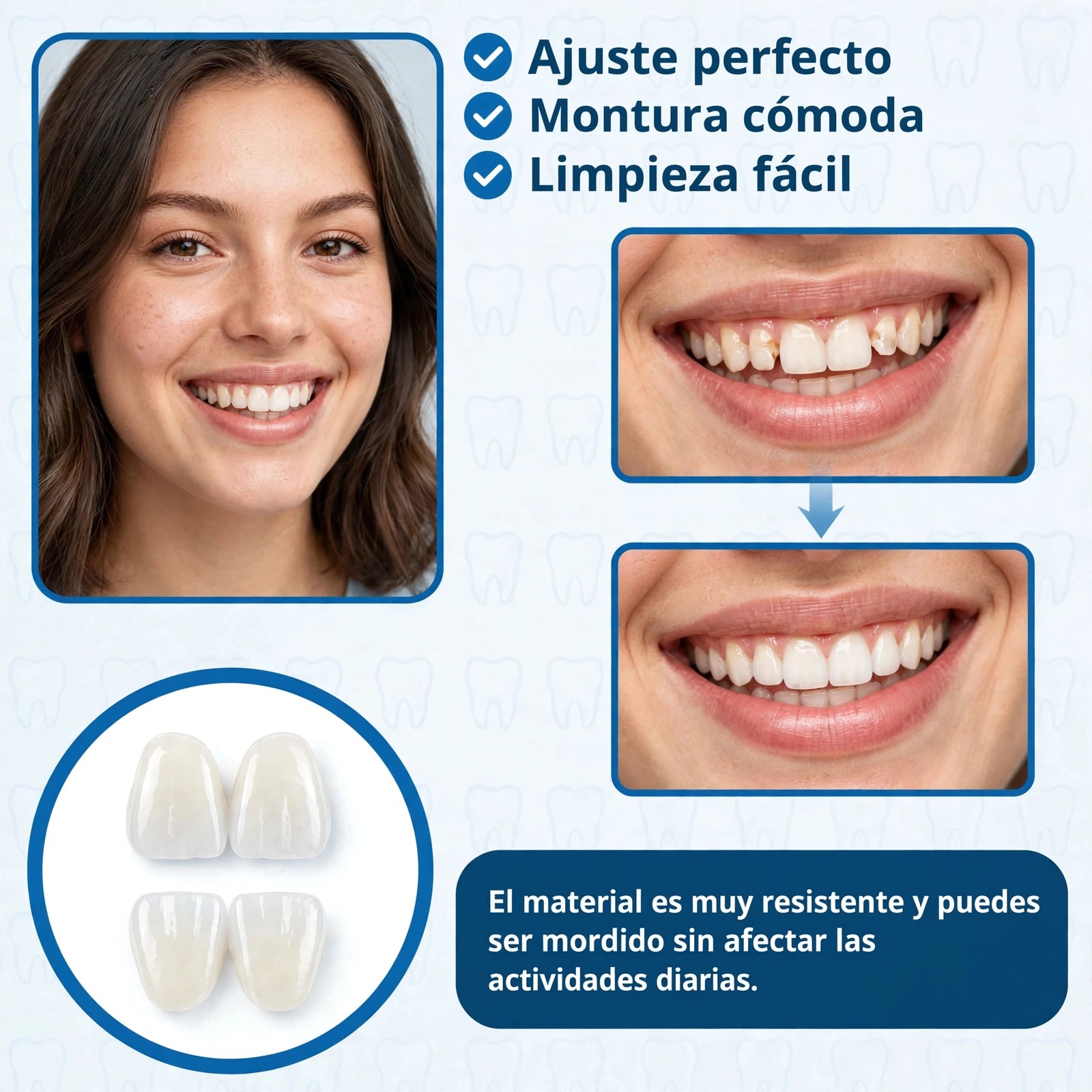 SmilePro 🦷 - Carillas Dentales Ajustables De Resina + ESTUCHE REGALO - ¡Últimas unidades!