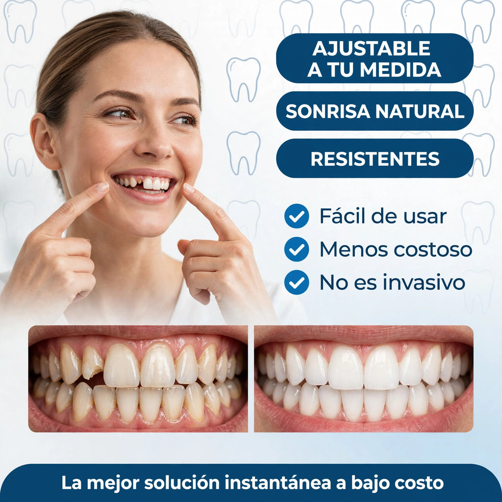 SmilePro 🦷 - Carillas Dentales Ajustables De Resina + ESTUCHE REGALO - ¡Últimas unidades!